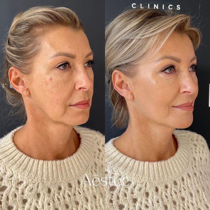 Natural Anti-Aging & face Skincare